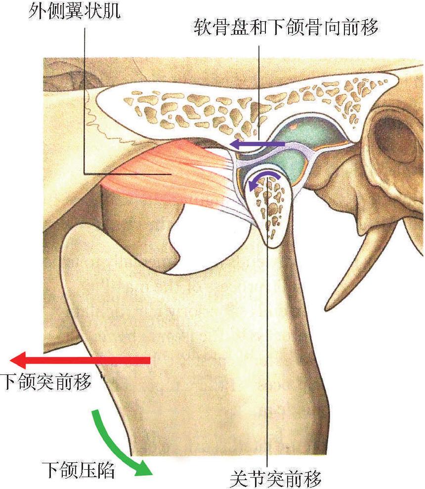 第一节 颞颌关节注射术